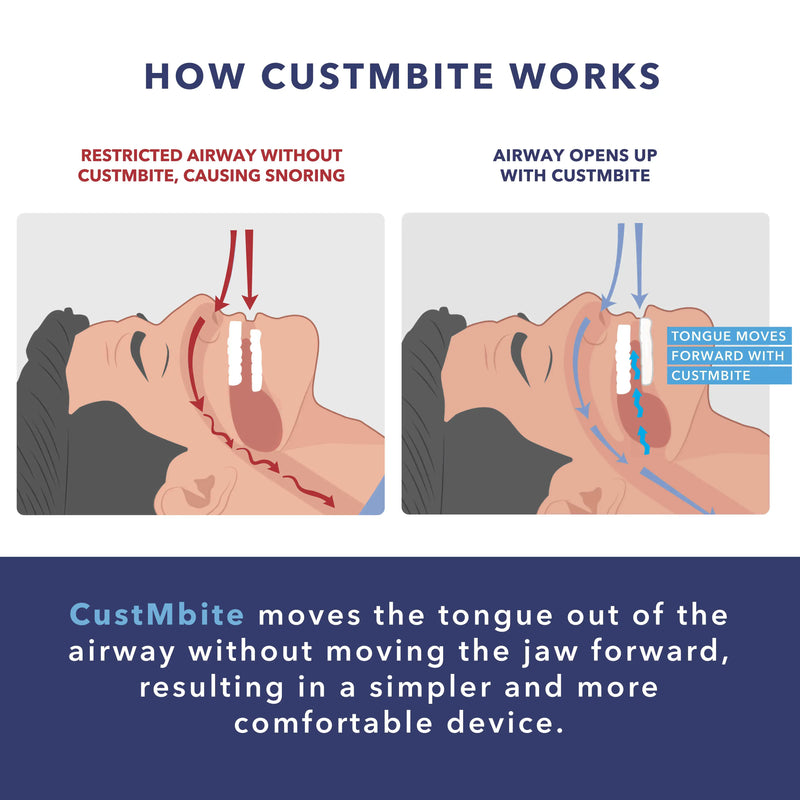 Open the airway to stop snoring and breath better. 